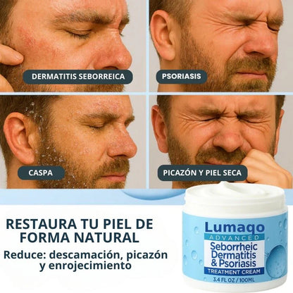 DermaCare - Recupere a sua barba e couro cabeludo em 14 dias
