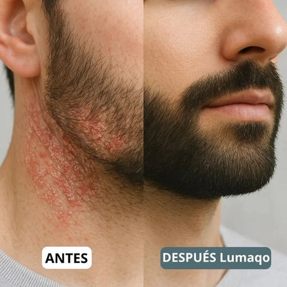 DermaCare - Recupere a sua barba e couro cabeludo em 14 dias